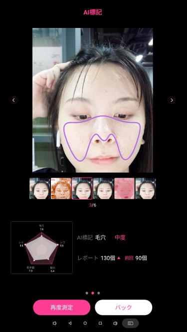 Pores