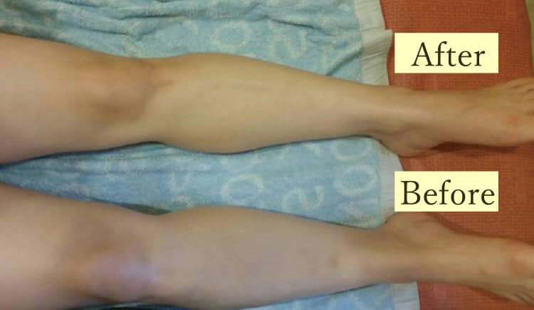 ①Quick Swelling Care