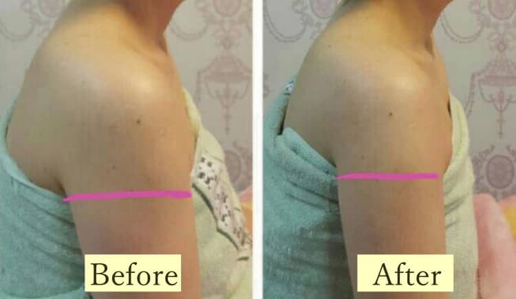 ②Quick slimming care