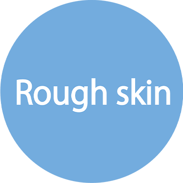 Tighten