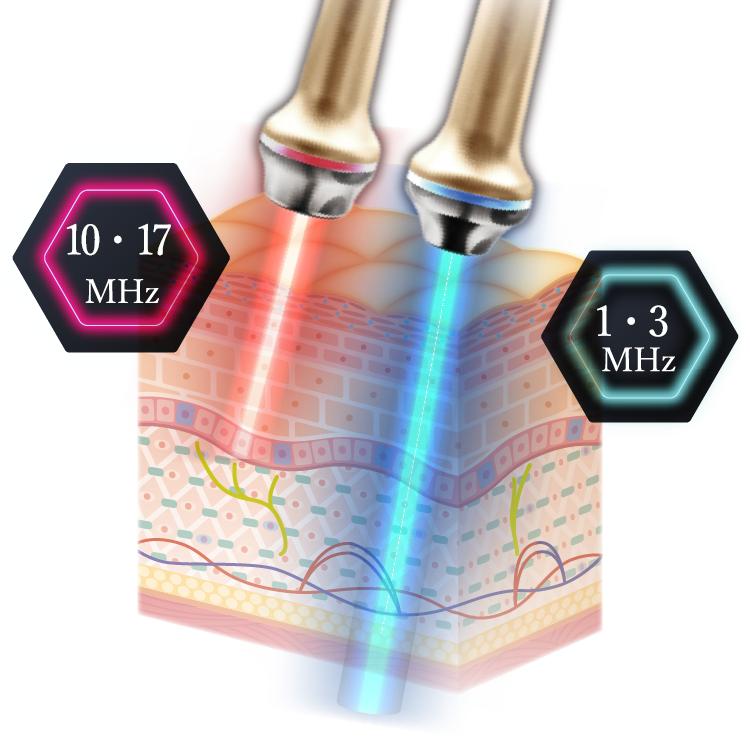 10･17MHz / 1･3MHz