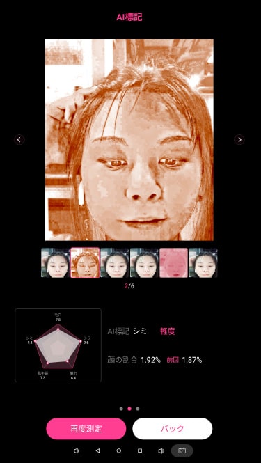 色素沈着